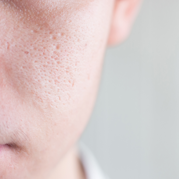 skin-concern-3