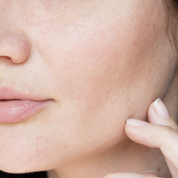 skin-concern-5